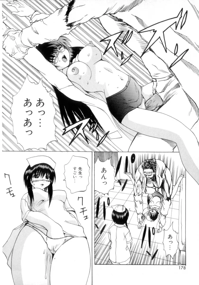 Page 179