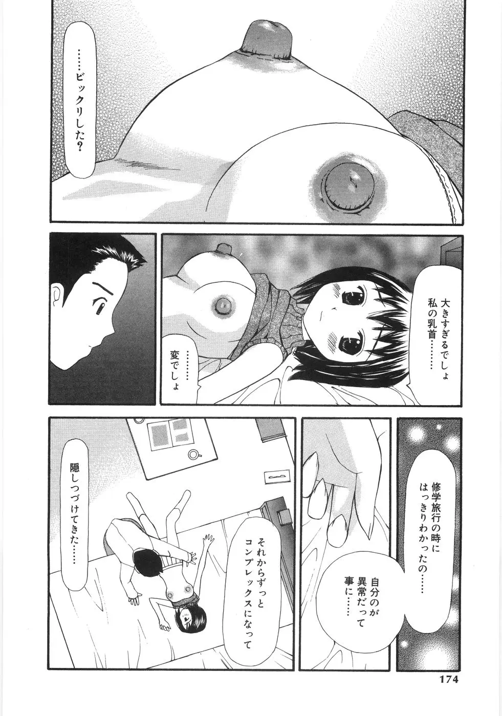 Page 172