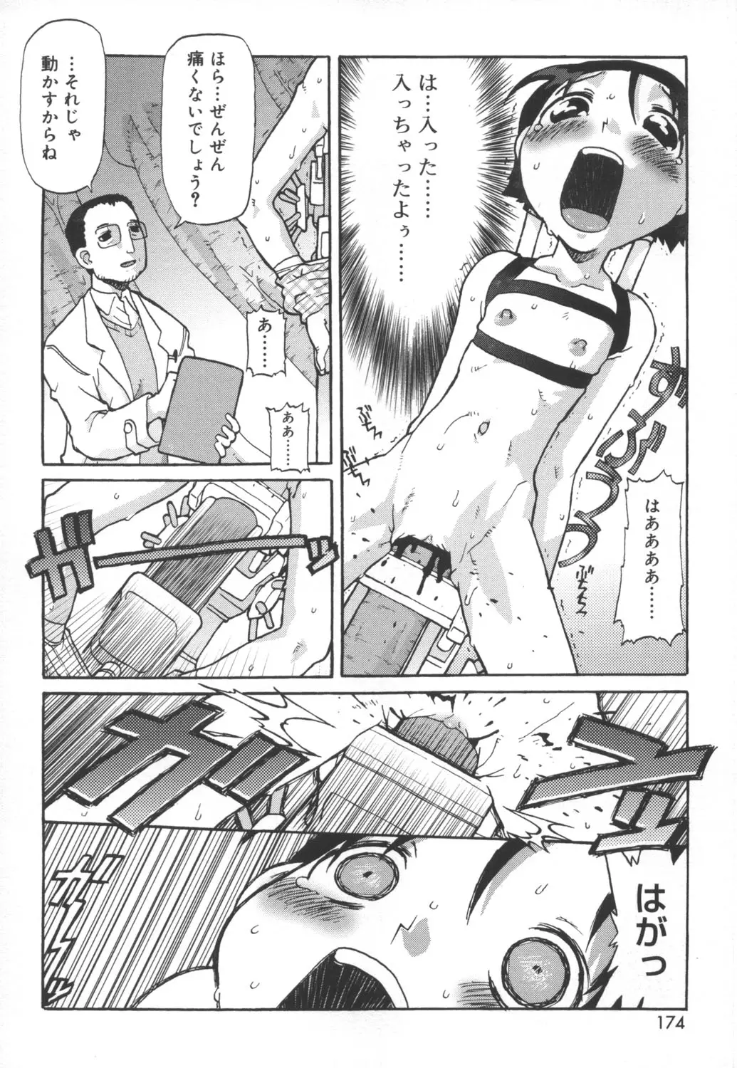 Page 172