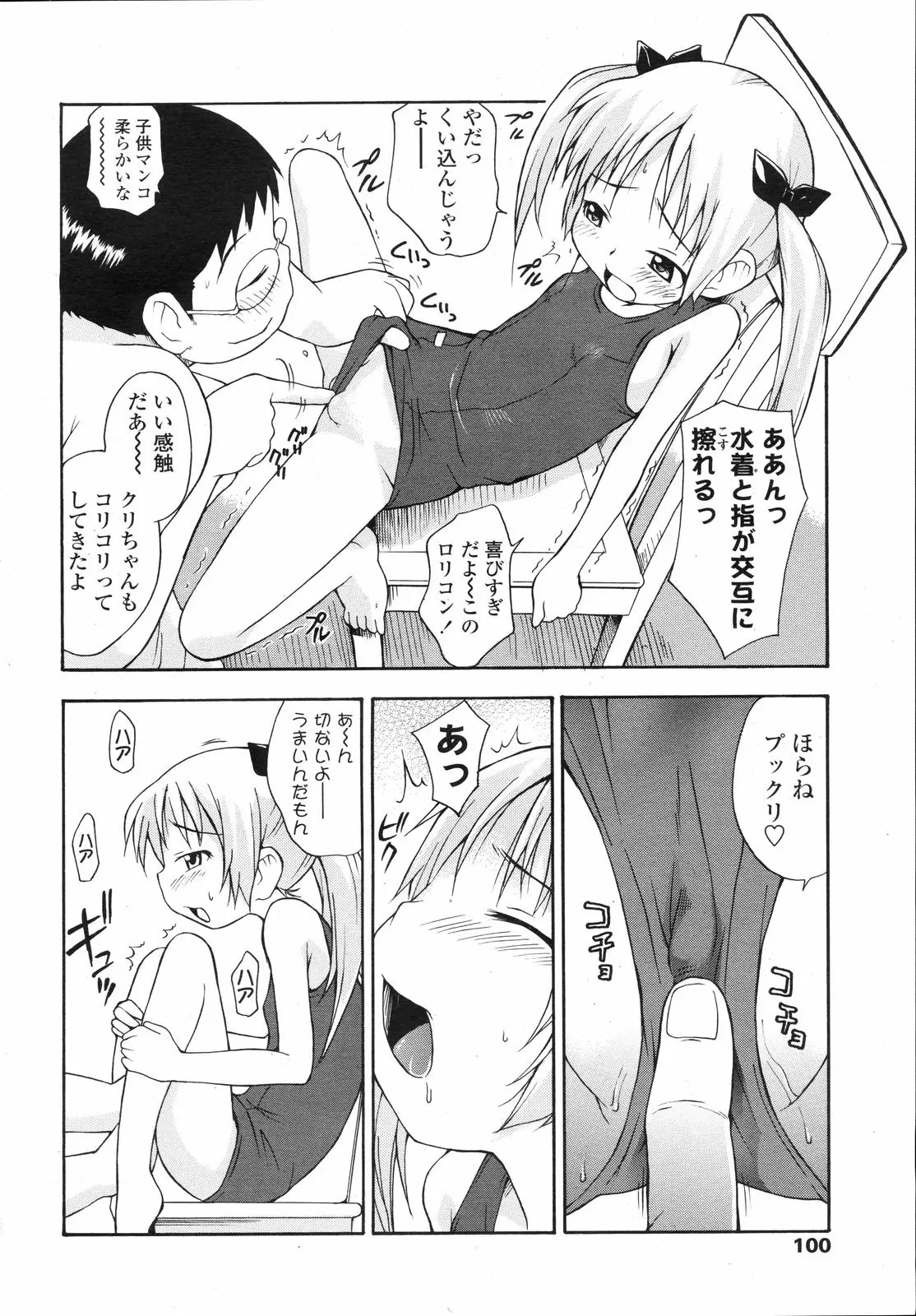 Page 100