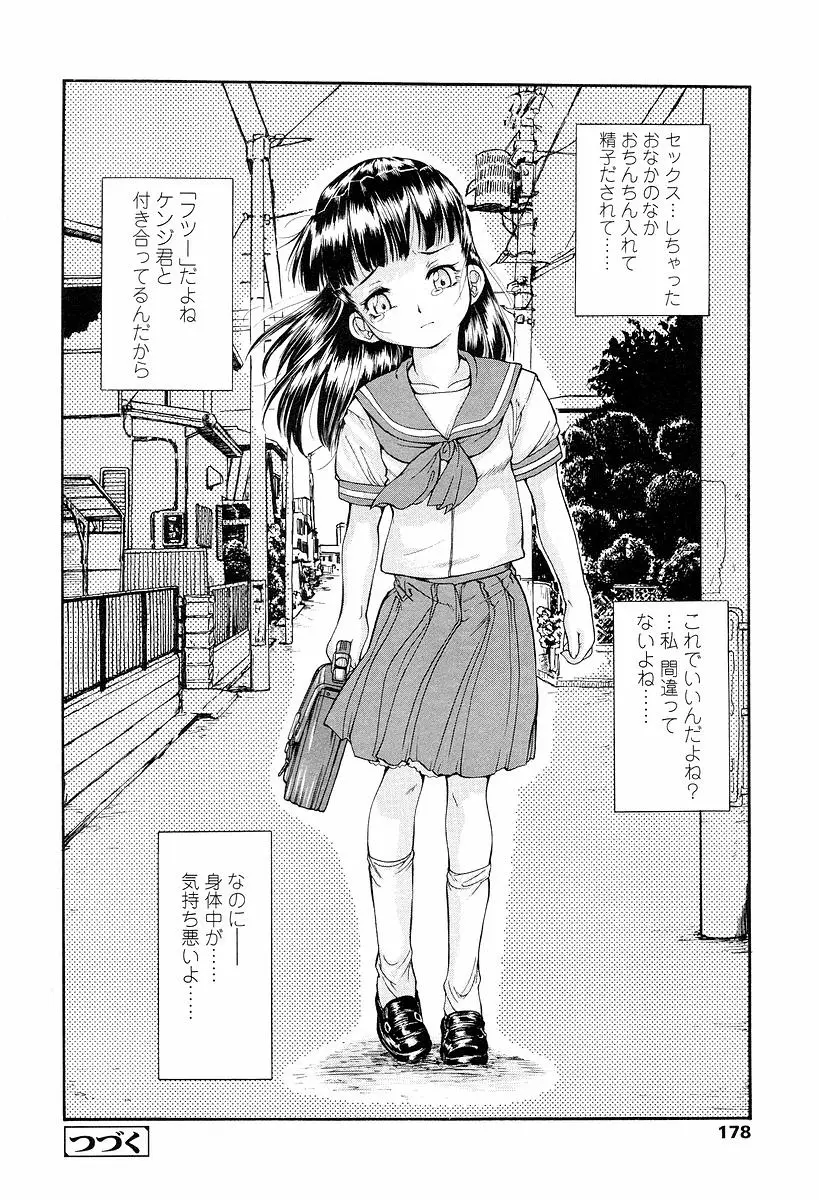 Page 179