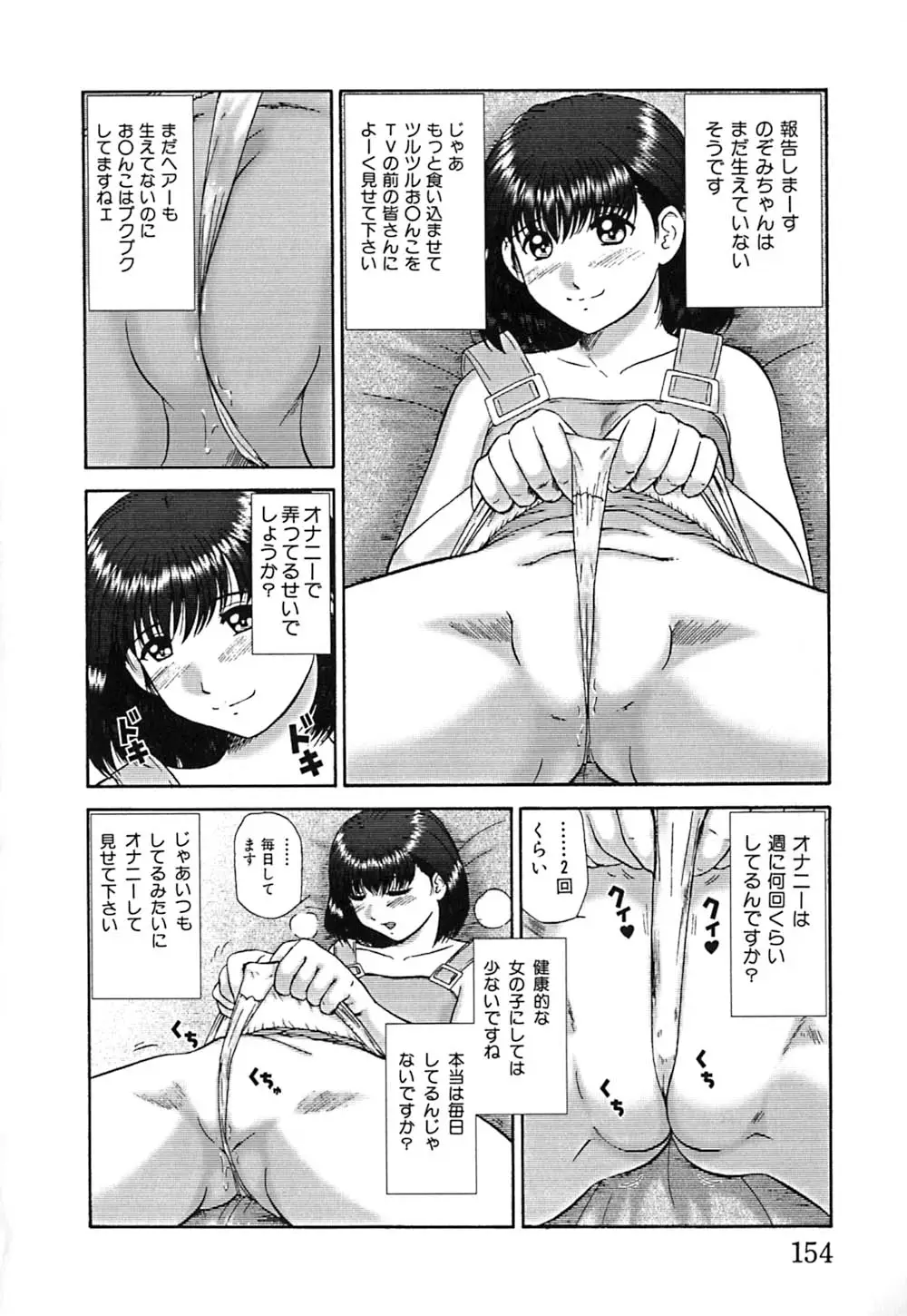 Page 157
